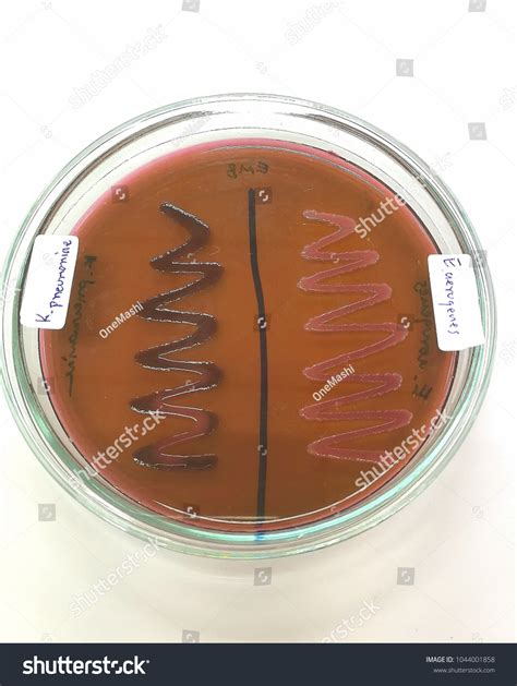 enterobacter aerogenes on emb|Eosin.